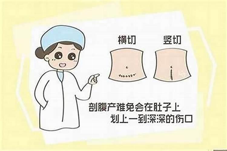 剖腹产生辰八字选择