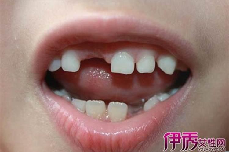 梦见自己的牙齿掉了很多是什么意思