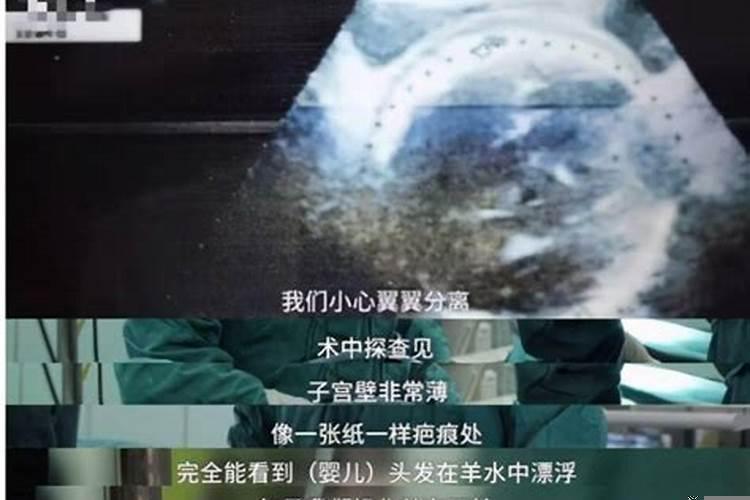 2025年4月哪天剖腹产最好