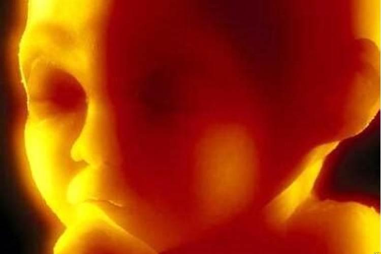 梦见狗是胎梦么