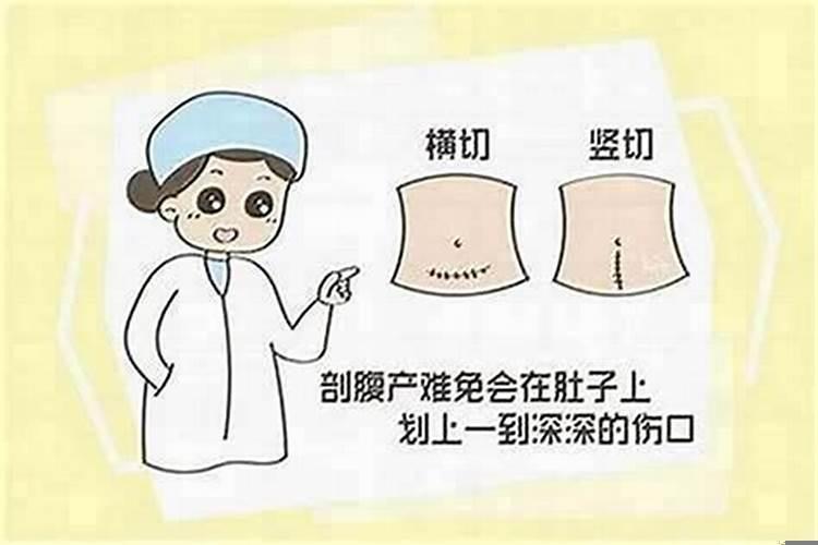 如何选择剖腹产时辰