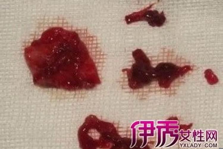 梦见别人摔死了流了好多血