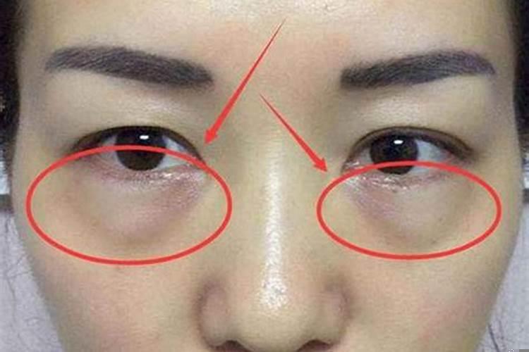 眼袋大的人命运
