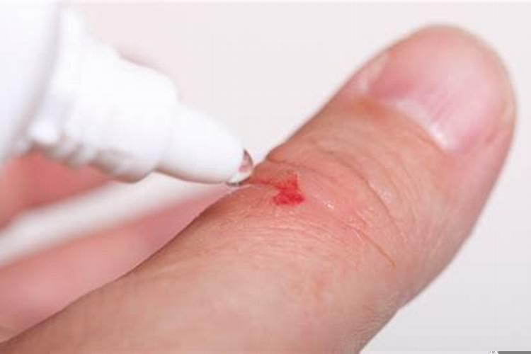 梦到自己脚踝受伤流血